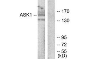 Western blot analysis of extracts from RAW264. (ASK1 anticorps  (AA 932-981))