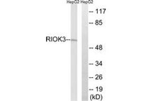 Western blot analysis of extracts from HepG2 cells, using RIOK3 Antibody. (RIOK3 anticorps  (AA 271-320))
