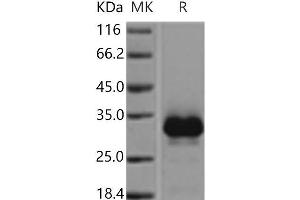 Western Blotting (WB) image for Tumor Necrosis Factor Receptor Superfamily, Member 11a, NFKB Activator (TNFRSF11A) protein (His tag) (ABIN7198426)