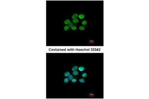 ICC/IF Image Immunofluorescence analysis of paraformaldehyde-fixed A431, using KAP1, antibody at 1:200 dilution. (KAP1 anticorps)