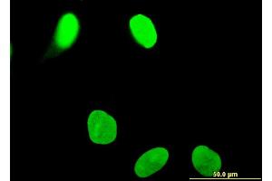 Immunofluorescence of monoclonal antibody to OTUD7B on HeLa cell.