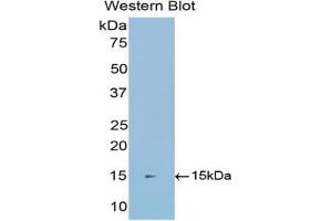 Western blot analysis of the recombinant protein.