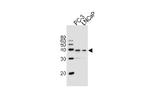 Western blot analysis of lysates from PC-3, LNCaP cell line (from left to right), using VDR Antibody at 1:1000 at each lane. (VD (AA 274-299) anticorps)