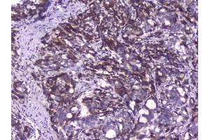 IHC analysis of CIC using anti-CIC antibody (ABIN6719536). (CIC anticorps  (AA 1433-1527))