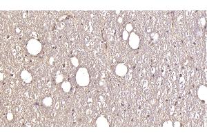 Detection of GRIA2 in Human Cerebellum Tissue using Monoclonal Antibody to Glutamate Receptor, Ionotropic, AMPA 2 (GRIA2)