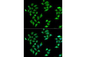 Immunofluorescence analysis of HeLa cell using ITLN1 antibody. (ITLN1/Omentin anticorps)