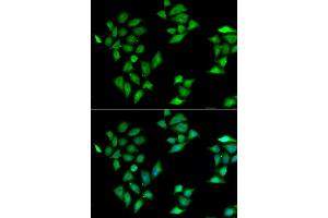 Immunofluorescence analysis of HeLa cell using ITLN1 antibody. (ITLN1/Omentin anticorps)