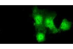Image no. 3 for anti-Glucan (1,4-alpha-), Branching Enzyme 1 (GBE1) antibody (ABIN1498395)