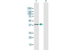 Western Blot analysis of CISH expression in transfected 293T cell line by CISH MaxPab polyclonal antibody.