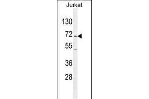 GAD2 Antibody (Center) (ABIN655070 and ABIN2844700) western blot analysis in Jurkat cell line lysates (35 μg/lane). (GAD65 anticorps  (AA 109-138))