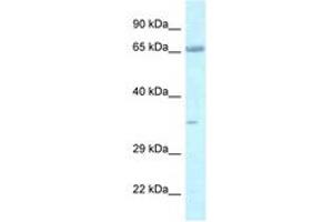 Image no. 1 for anti-Leucine Zipper, Putative Tumor Suppressor 1 (LZTS1) (AA 530-579) antibody (ABIN6747423)