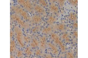 Used in DAB staining on fromalin fixed paraffin- embedded kidney tissue (FPGS anticorps  (AA 210-439))