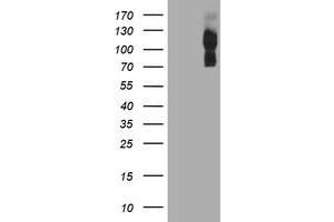 HEK293T cells were transfected with the pCMV6-ENTRY control (Left lane) or pCMV6-ENTRY ENPEP (Right lane) cDNA for 48 hrs and lysed. (ENPEP anticorps)