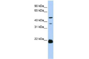 WB Suggested Anti-ZDHHC14 Antibody Titration:  0. (ZDHHC14 anticorps  (N-Term))