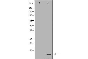 Western blot analysis of extracts from HepG2, using DEFB121 antibody. (DEFB121 anticorps  (Internal Region))