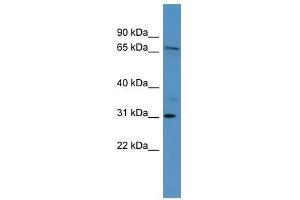Western Blot showing RGL3 antibody used at a concentration of 1-2 ug/ml to detect its target protein.