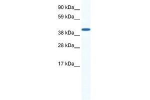 WB Suggested Anti-ZFP36L1 Antibody Titration: 0. (ZFP36L1 anticorps  (N-Term))