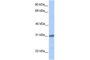 WB Suggested Anti-C7orf61 Antibody Titration: 0. (C7orf61 anticorps  (C-Term))