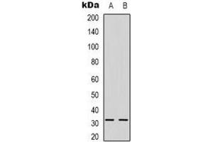 Western blot analysis of NGF beta expression in Raji (A), HepG2 (B) whole cell lysates. (NGFB anticorps)