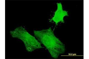 Immunofluorescence of purified MaxPab antibody to H1FOO on HeLa cell.