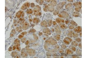 Immunoperoxidase of monoclonal antibody to GSR on formalin-fixed paraffin-embedded human salivary gland.