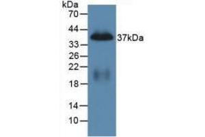Western blot analysis of recombinant Mouse PP.