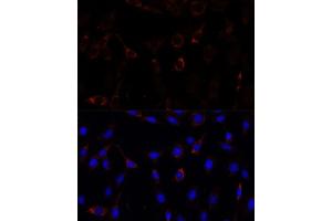 Immunofluorescence analysis of C6 cells using RNF112 antibody (ABIN7270054) at dilution of 1:100.