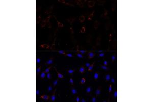 Immunofluorescence analysis of C6 cells using RNF112 antibody (ABIN7270054) at dilution of 1:100. (RNF112 anticorps  (AA 200-500))