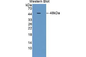 Western blot analysis of the recombinant protein. (TGFBR2 anticorps  (AA 209-590))