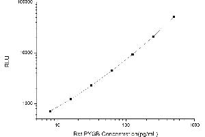 Typical standard curve (PYGB Kit CLIA)