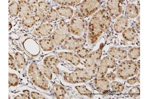 Immunoperoxidase of purified MaxPab antibody to TSNAXIP1 on formalin-fixed paraffin-embedded human stomach.