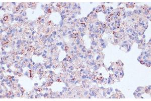 Immunohistochemistry of paraffin-embedded Rat lung using CD18 Polyclonal Antibody at dilution of 1:100 (40x lens). (Integrin beta 2 anticorps)