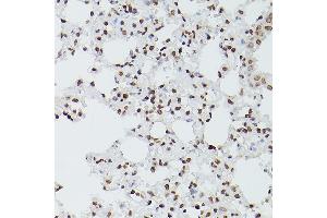 Immunohistochemistry of paraffin-embedded mouse lung using G antibody (ABIN6133721, ABIN6140975, ABIN6140976 and ABIN6217864) at dilution of 1:150 (40x lens).