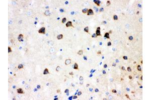 Anti- SSH3BP1 Picoband antibody, IHC(P) IHC(P): Mouse Brain Tissue (ABI1 anticorps  (N-Term))