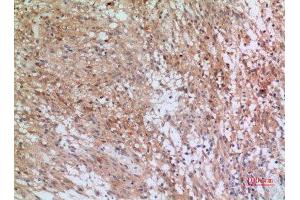 Immunohistochemistry (IHC) analysis of paraffin-embedded Human Brain, antibody was diluted at 1:100. (INHBB anticorps  (C-Term))