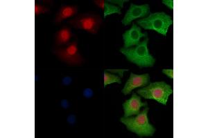 ABIN6256503 and ABIN6267060 staining Hela cells by IF/ICC. (ERK1 anticorps  (pThr202, pTyr204))