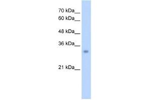 WB Suggested Anti-ECH1 Antibody Titration:  2. (ECH1 anticorps  (N-Term))