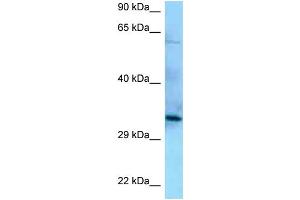 WB Suggested Anti-PPP6C Antibody Titration: 1. (PPP6C anticorps  (N-Term))