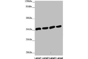 Western blot All lanes: ANKRD1 antibody at 1. (ANKRD1 anticorps  (AA 1-130))