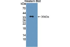 Western blot analysis of the recombinant protein. (Pirin anticorps  (AA 1-290))