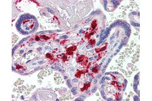 Anti-F13A1 / Factor XIIIa antibody IHC of human placenta. (F13A1 anticorps)