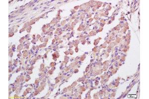 Formalin-fixed and paraffin embedded mouse embryo labeled with Anti-RNF123 Polyclonal Antibody, Unconjugated  at 1:200 followed by conjugation to the secondary antibody and DAB staining