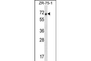 RCOR1 Antibody (N-term) (ABIN1538927 and ABIN2848670) western blot analysis in ZR-75-1 cell line lysates (35 μg/lane).