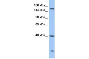 WB Suggested Anti-CPD Antibody Titration: 0.