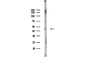 anti-Ceramide Synthase 1 (CERS1) antibody