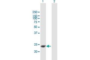 Western Blot analysis of C1QTNF3 expression in transfected 293T cell line by C1QTNF3 MaxPab polyclonal antibody.