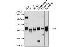 Western blot analysis of extracts of various cell lines, using PEPD antibody. (PEPD anticorps  (AA 288-424))