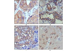 Immunohistochemical analysis of paraffin-embedded human lung cancer (A), thyroid cancer (B), lymph node (C) and brain (D) showing cytoplasmic and extracellular matrix localization using WNT5A mouse mAb with DAB staining. (WNT5A anticorps)