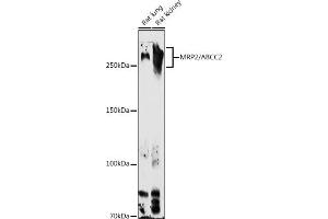 Western blot analysis of extracts of various cell lines, using MRP2/ antibody (ABIN6129853, ABIN6136357, ABIN6136358 and ABIN6224455) at 1:1000 dilution.