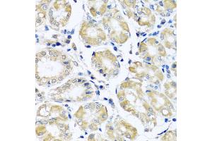 Immunohistochemistry of paraffin-embedded human stomach using NDUFB10 antibody (ABIN5972156) at dilution of 1/100 (40x lens). (NDUFB10 anticorps)